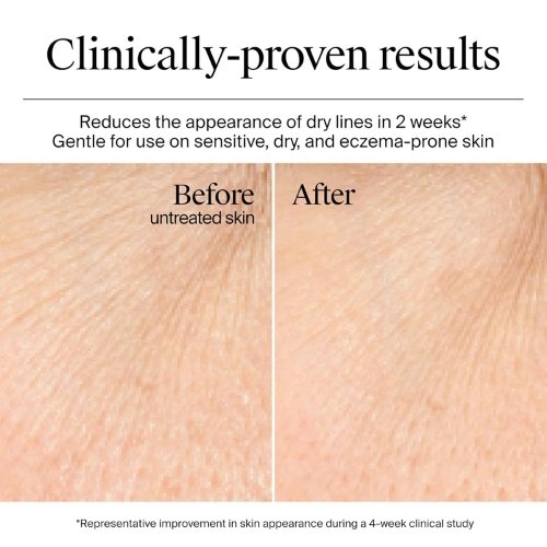Neutrogena Hydro Boost Gel Cream Review: Lightweight Hydration - Image 3